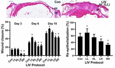 Parameter-Dependency of Low-Intensity Vibration for Wound Healing in Diabetic Mice